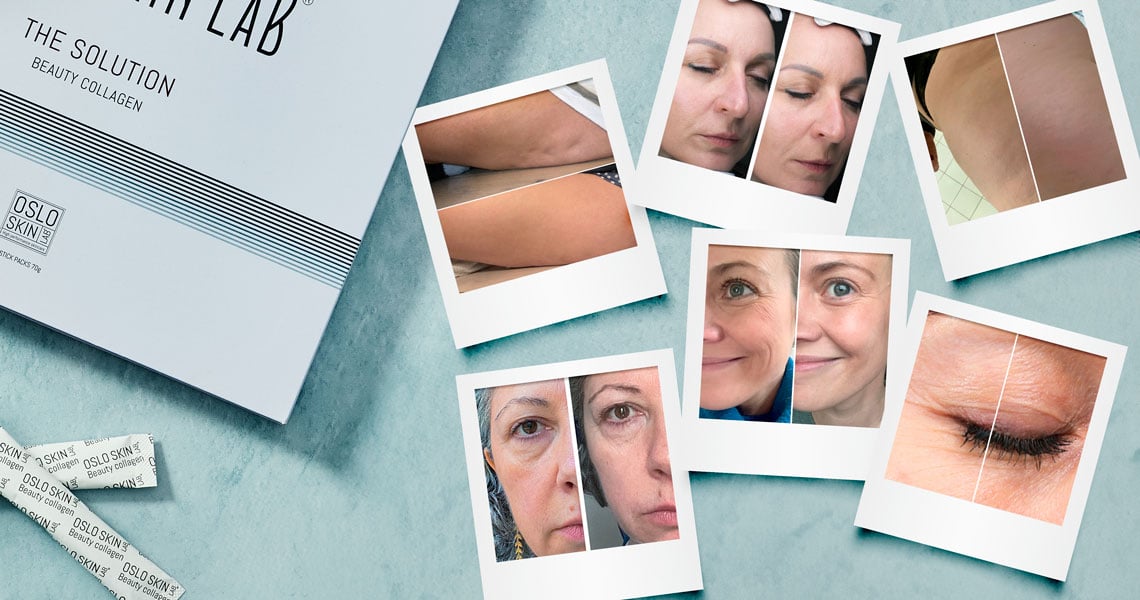 polaroidové fotky před a po použití kolagenu The Solution položené na stole, vedle fotek je položená krabička kolagenu The Solution